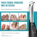 Toenail Clippers for Seniors Thick Toenails, RONAVO Heavy Duty Toe Nail Clippers Adult Thick Nails Long Handle, Large Toenail Clippers for Thick Nails 4Pcs (Black) gallery image