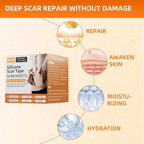 Miniatura 2 de Hojas de silicona para cicatrices (rollo de 1.6 x 79 pulgadas, 6.6 ft), tiras de silicona reutilizables para cicatrices, cintas de silicona suave