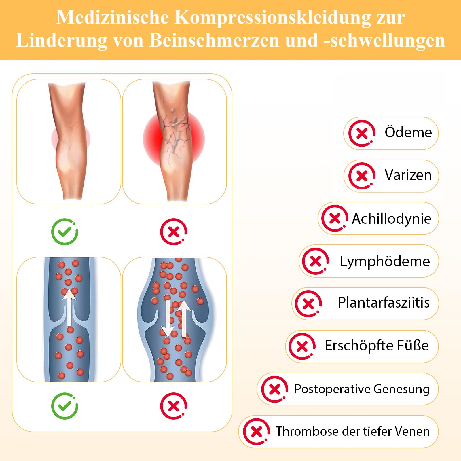 Medizinische Kompressionsstrumpfhose Damen Lang 22-32mmHg Klasse 2,Blickdichte Stützstrumpfhose mit Geschlossener Fußspitze,Kompressionsstrümpfe für Schwangerschaft Lipödem Flug & Krampfade Ödeme