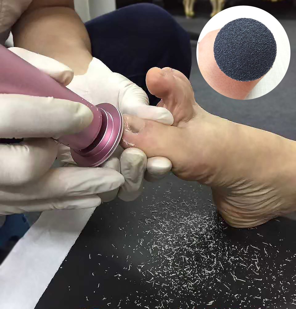 Rallador de pies pedicura Eléctrico Anticalesidad Lima Pies Eléctrico para Cuerno (velocidad ajustable) con 60 almohadillas de repuesto para mujeres hombres pedicuras, sin necesidad de batería (Rosa)