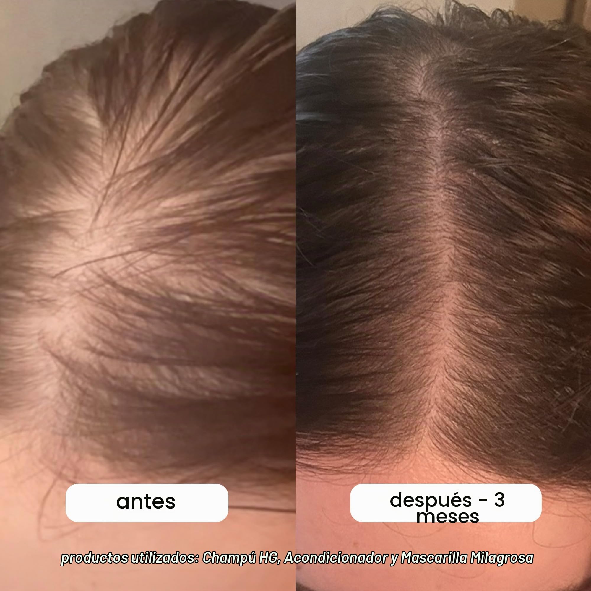BondiBoost Champú HG, mejora la apariencia del cabello fino, fórmula voluminizadora, sin sulfato ni parabenos, unisex, vegano/libre de crueldad, fabricado en Australia, 10.14 onzas líquidas