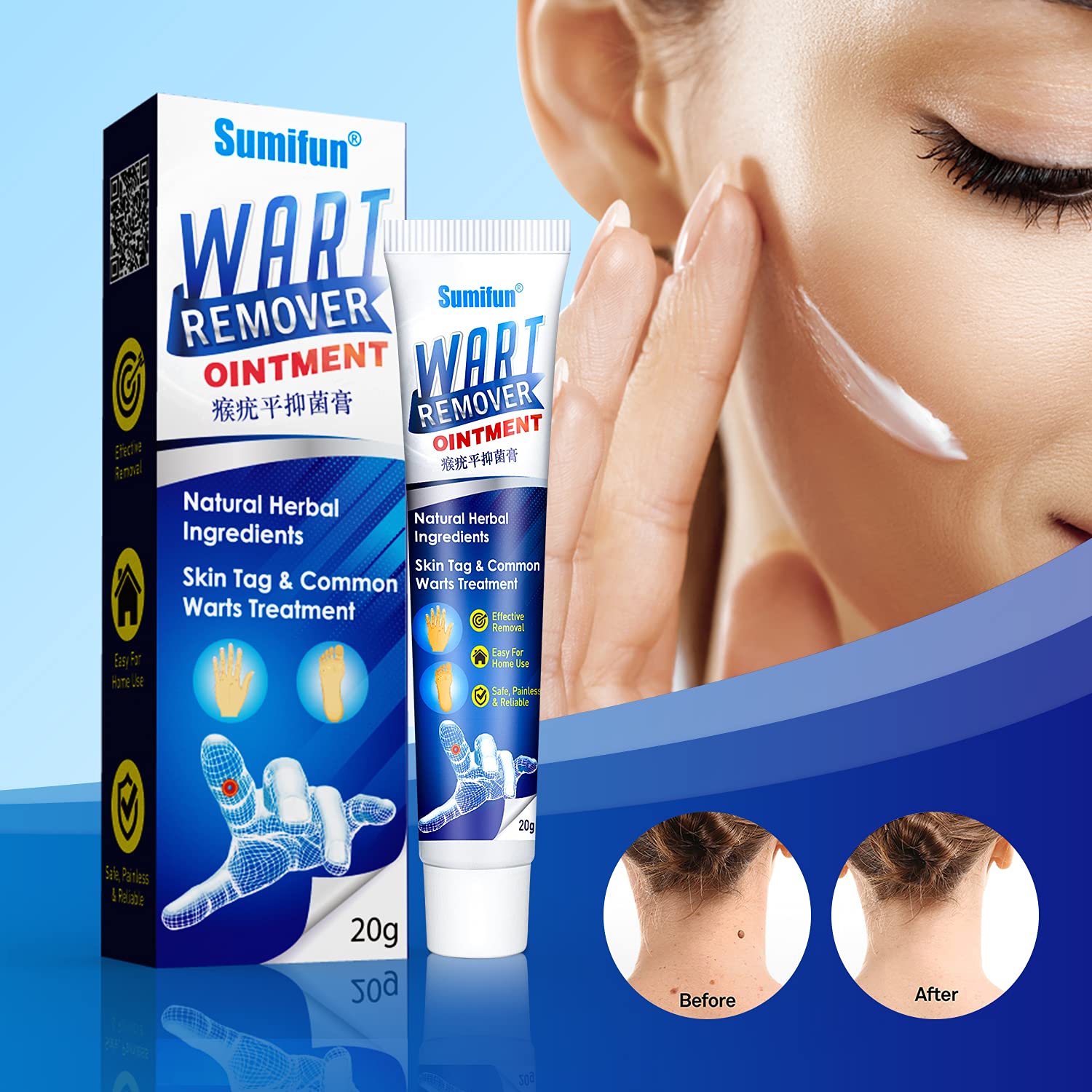 Sumifun Wart Remover Ointment 3 Counts Skin Tag Remover, Wart Remover