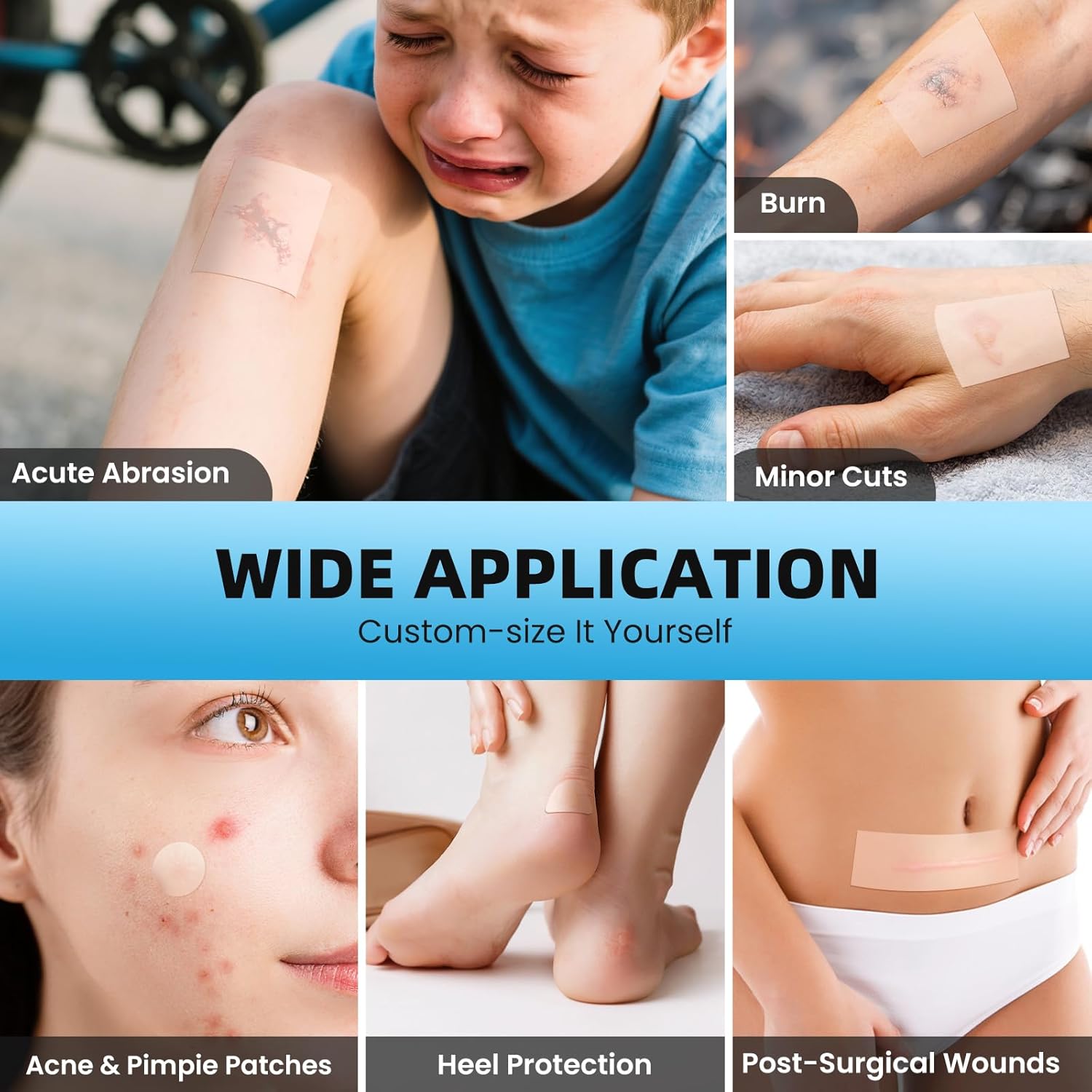 Hydrocolloid Roll Bandages, 2IN x 16FT Extra Large Hydrocolloid Patch with Self-Adhesive, Ultra Absorbent, Cut-to-Size, Flexible & Waterproof for Burn, Blister, Acne Care