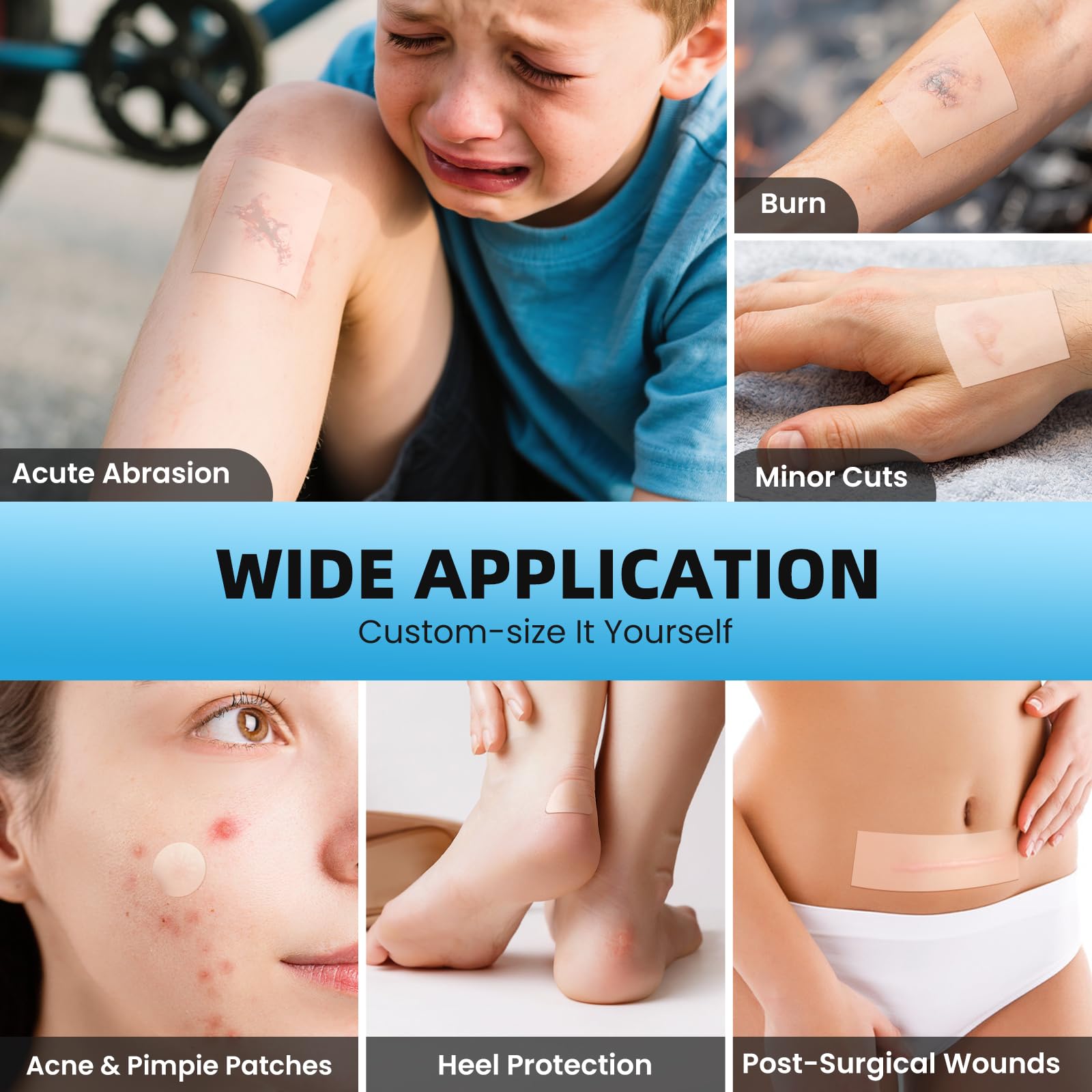 Hydrocolloid Bandages - Large, Acne & Burn Care -4 Hydrocolloid Bandages - Large, Acne & Burn Care -4