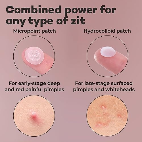 Miniatura 3 de OMMA Paquete de 144 parches para espinillas para cara y 36 parches para acné Microdart