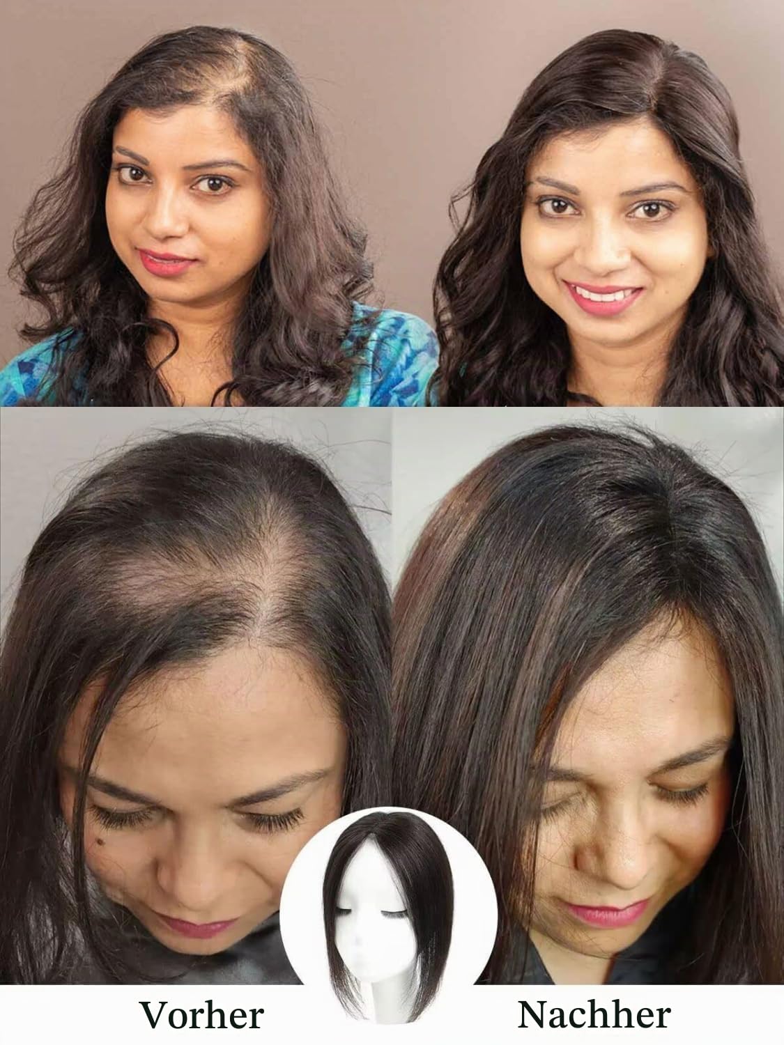 Braun Haarteile Für Dünnes Haar Haartopper Echthaar Oberkopf Damen 360°3D Cover Brown Human Hair Topper For Women Upgrade Lace Base Cilp In Hair Extensions gift For Her