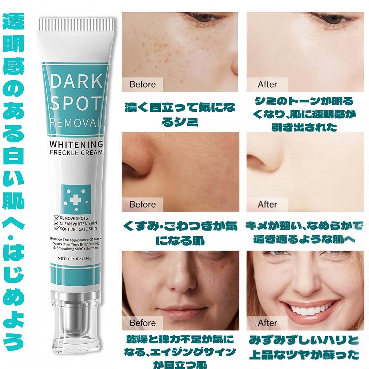 Amazon | 美白クリーム 肝斑リペアクリーム しみそばかす 消す 顔に