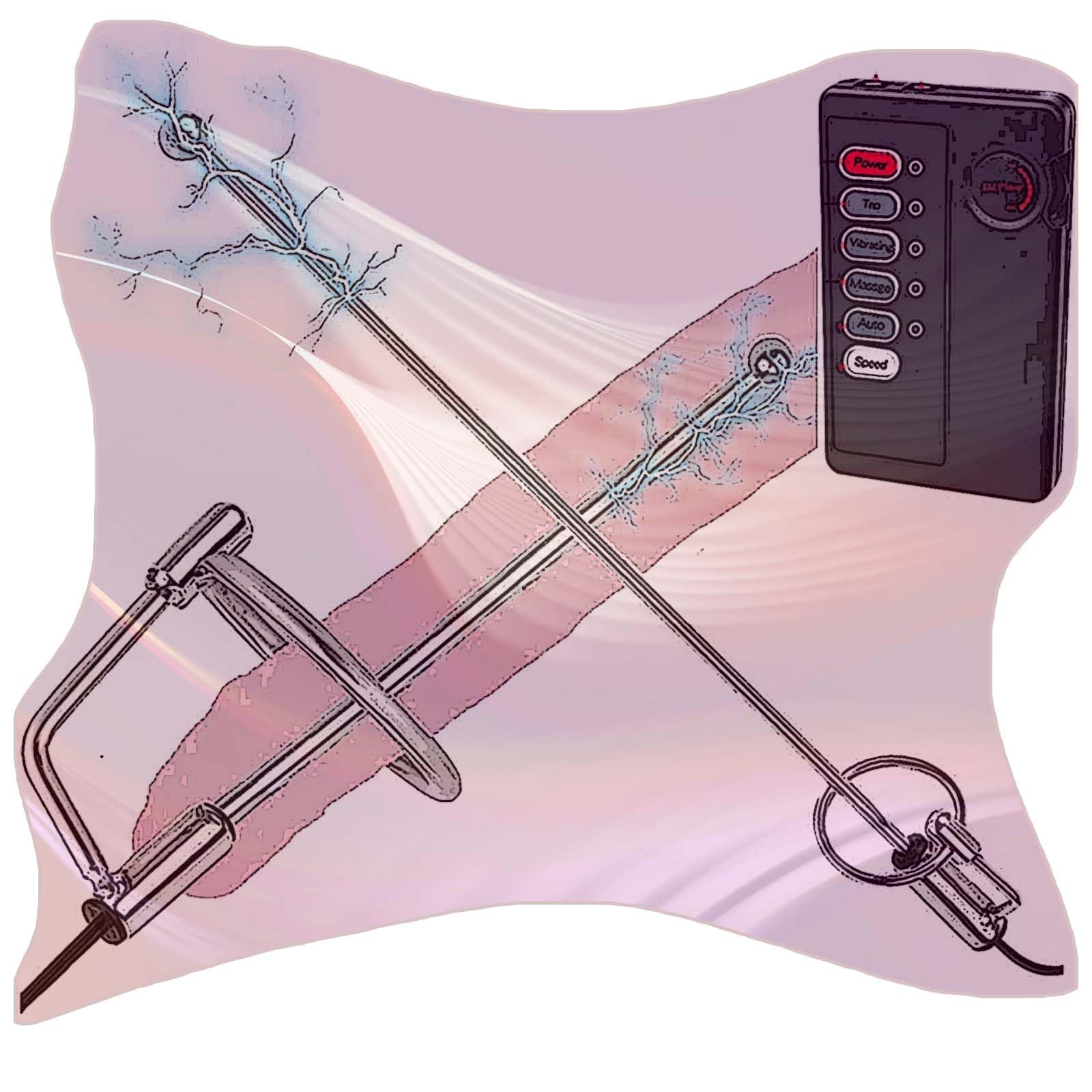 Asta sonora in acciaio inossidabile con controller, set fitness per barella di stimolazione speciale maschile -D17IT (B:10mm)