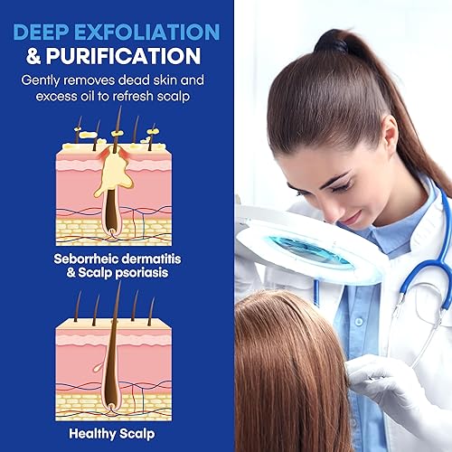 Miniatura 5 de Champú medicado para la dermatitis seborreica del cuero cabelludo y la psoriasis Fórmula a base de plantas alivia la picazón, reduce las escamas,