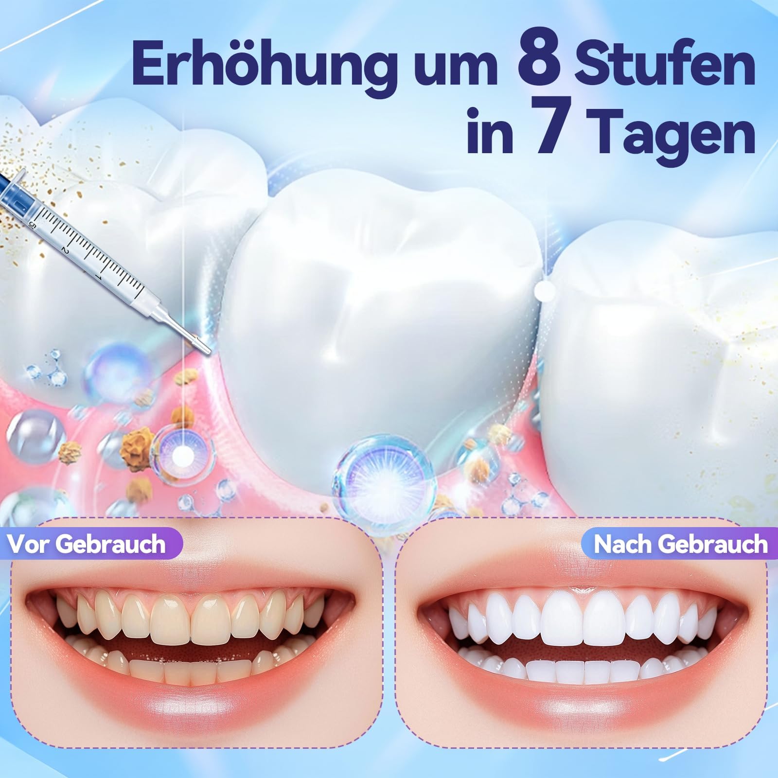 Zahnaufhellung Bleaching Set,Bleaching Gele & Zähne Bleaching Stift,Teeth Aufhellung Gel,Effektives Zahnbleaching für weiße Zähne,Flecken Entfernen