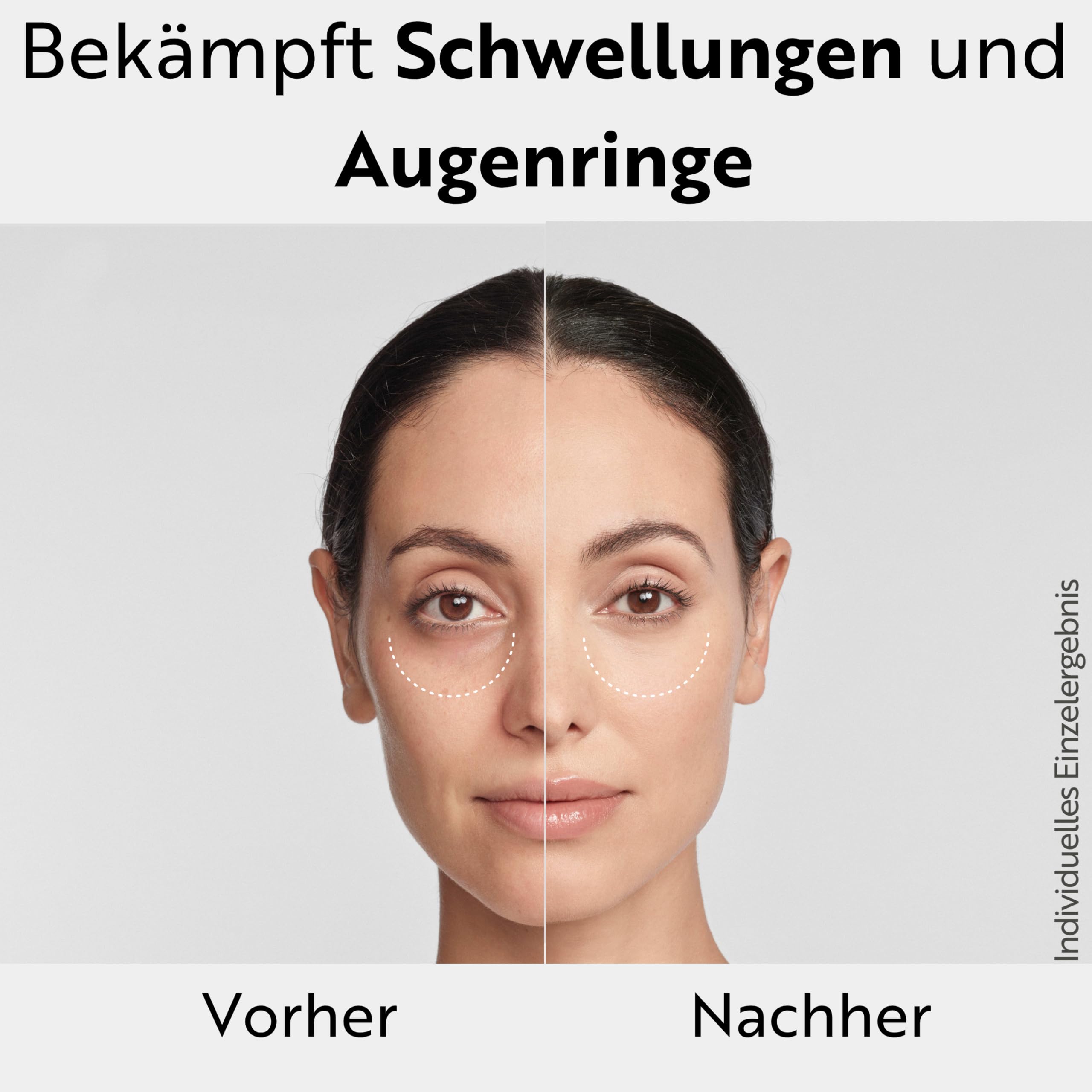 M. Asam MAGIC CARE Perfect Eye Augenserum (25 ml) – Gegen Dunkle Augenringe und Schwellungen, Serum Mit 360° Straffungseffekt & Hyaluronsäure