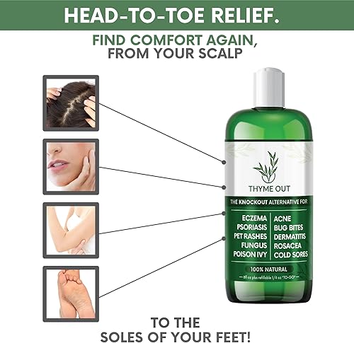 Miniatura 7 de Thyme Out Tratamiento natural para la piel para aliviar el eccema la psoriasis el acné la dermatitis la rosácea el herpes labial las erupciones de