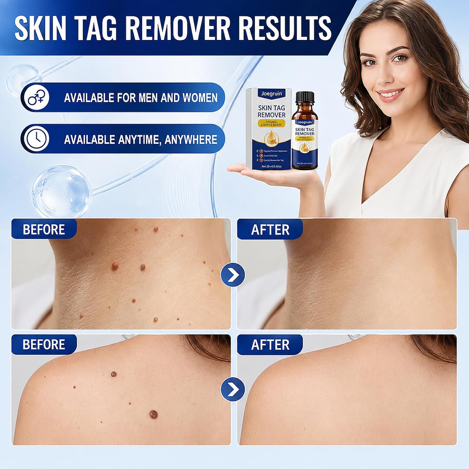 Fast-Acting Skin Tag Remover- Safe,Natural, Mild Salicylic Acid Formula