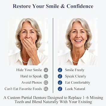 Custom Partial Dentures for Missing Teeth (1 Tooth)