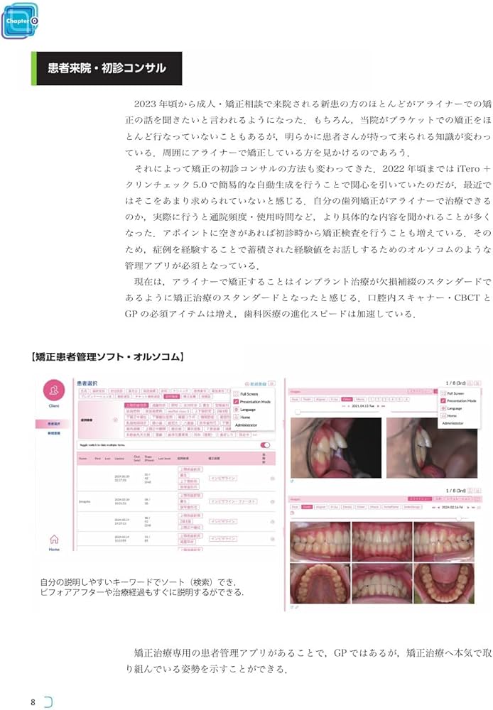 裁断済み　GPがアライナー矯正を行うときに外せないポイント 71vbOpZXDiL._AC_UF1000,