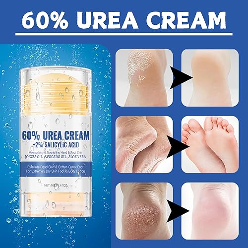 Miniatura 5 de 2 unidades de crema de urea al 60% y crema de pies de ácido salicílico al 2%, crema hidratante para pies, se puede utilizar para codos, rodillas y