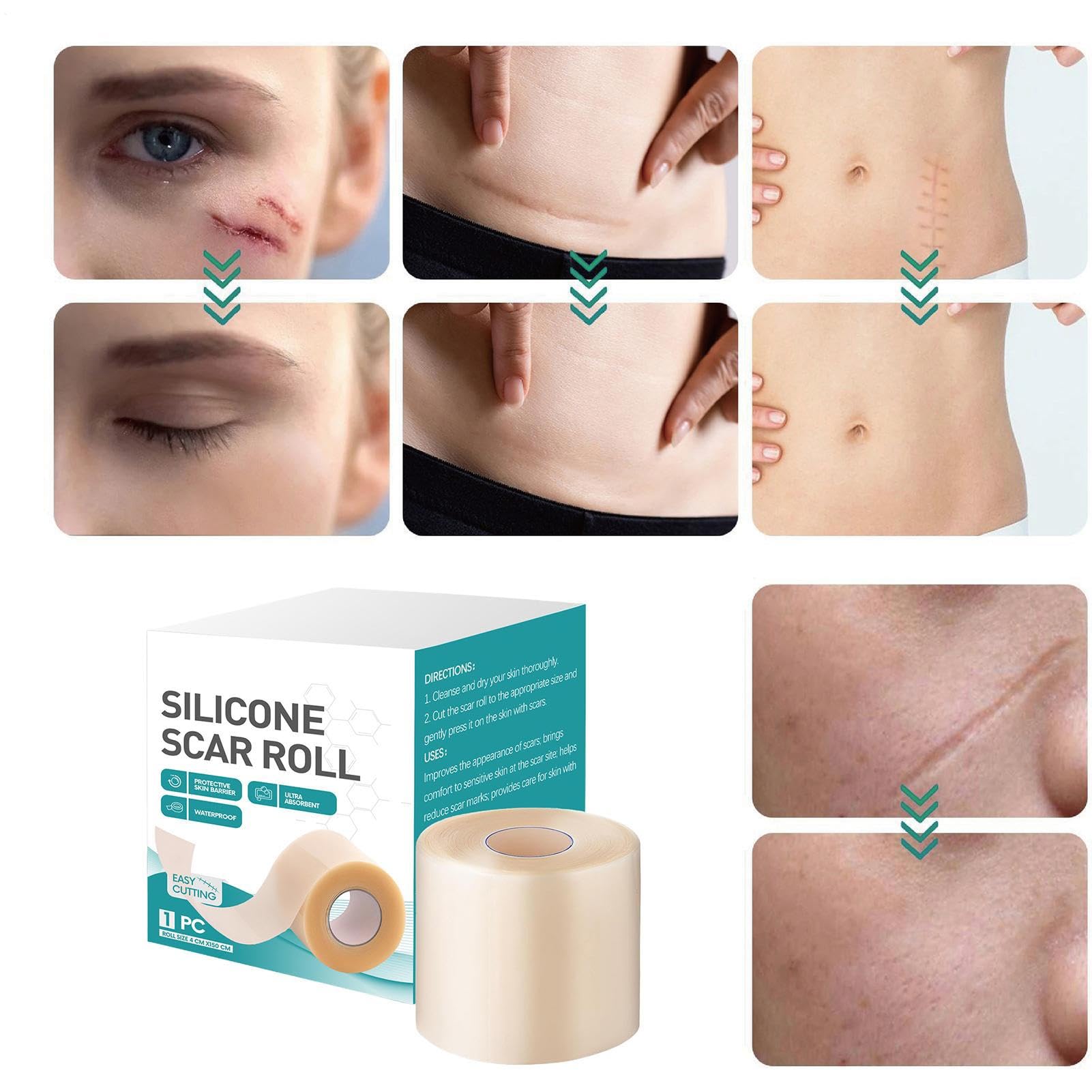 Fogli di cicatrici in silicone, nastro per il viso in silicone per la guarigione delle cicatrici da ustioni - Strisce di riparazione della guarigione veloce Provazioni di bellezza