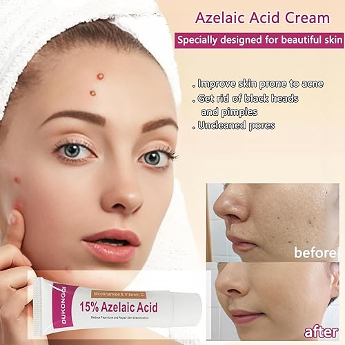 Miniatura 6 de Ácido azelaico para equilibrar el tono de la piel y limpiar los poros, suero de ácido azelaico para aliviar el acné, puntos negros y enrojecimiento,