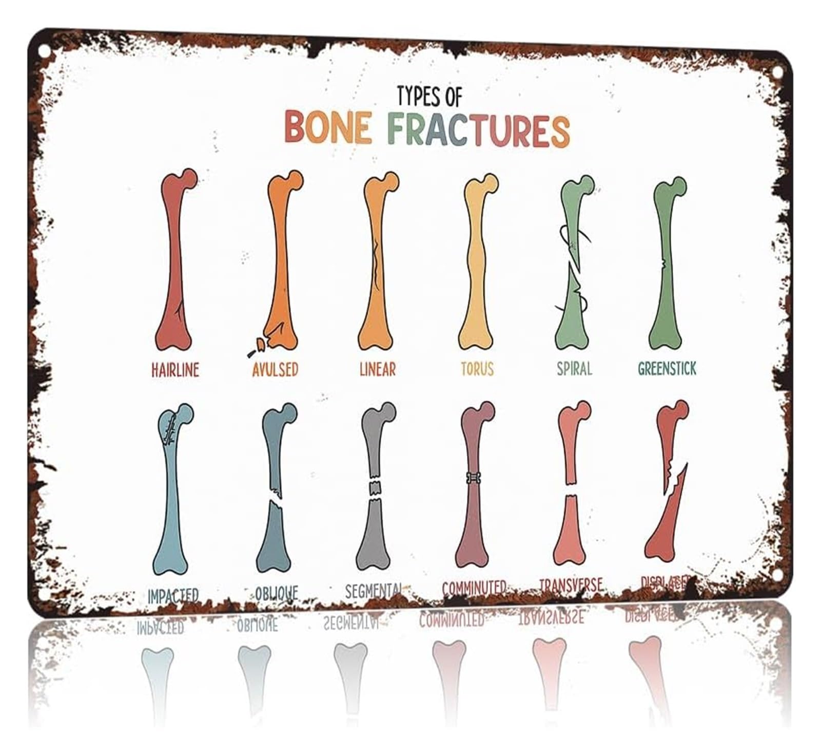 AUOQKQUT Rustic Metal Tin Sign Bone Break Identification Guide Wall Poster for Nursing Student Gift 8 X 12 inch