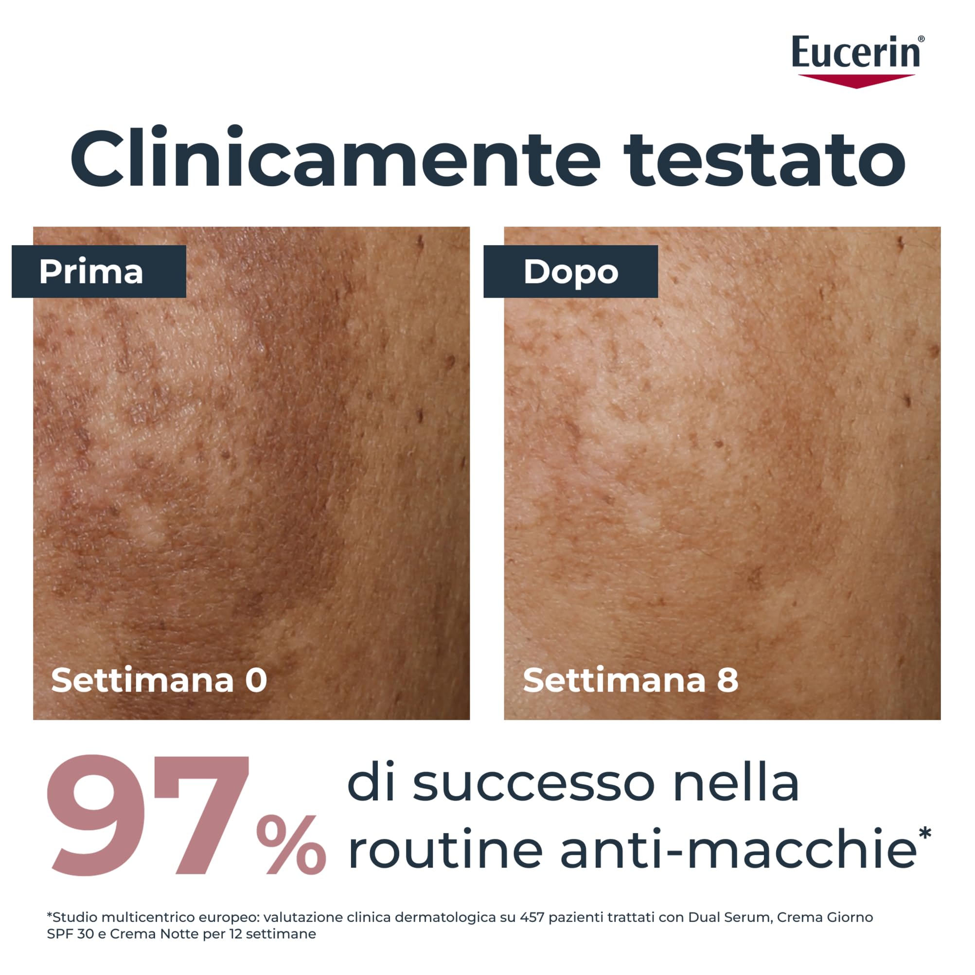 Eucerin Anti-Pigment Siero Viso Dual Serum 30 ml, Siero antimacchia viso concentrato per una pelle uniforme e levigata, Formula con Acido Ialuronico e Thiamidol per tutti i tipi di pelle