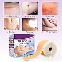 Vista 3 de Rollo de cinta de silicona para cicatrices, cinta médica de 1.6 x 60 pulgadas para vendajes para el cuidado de heridas, tiras de cicatrices