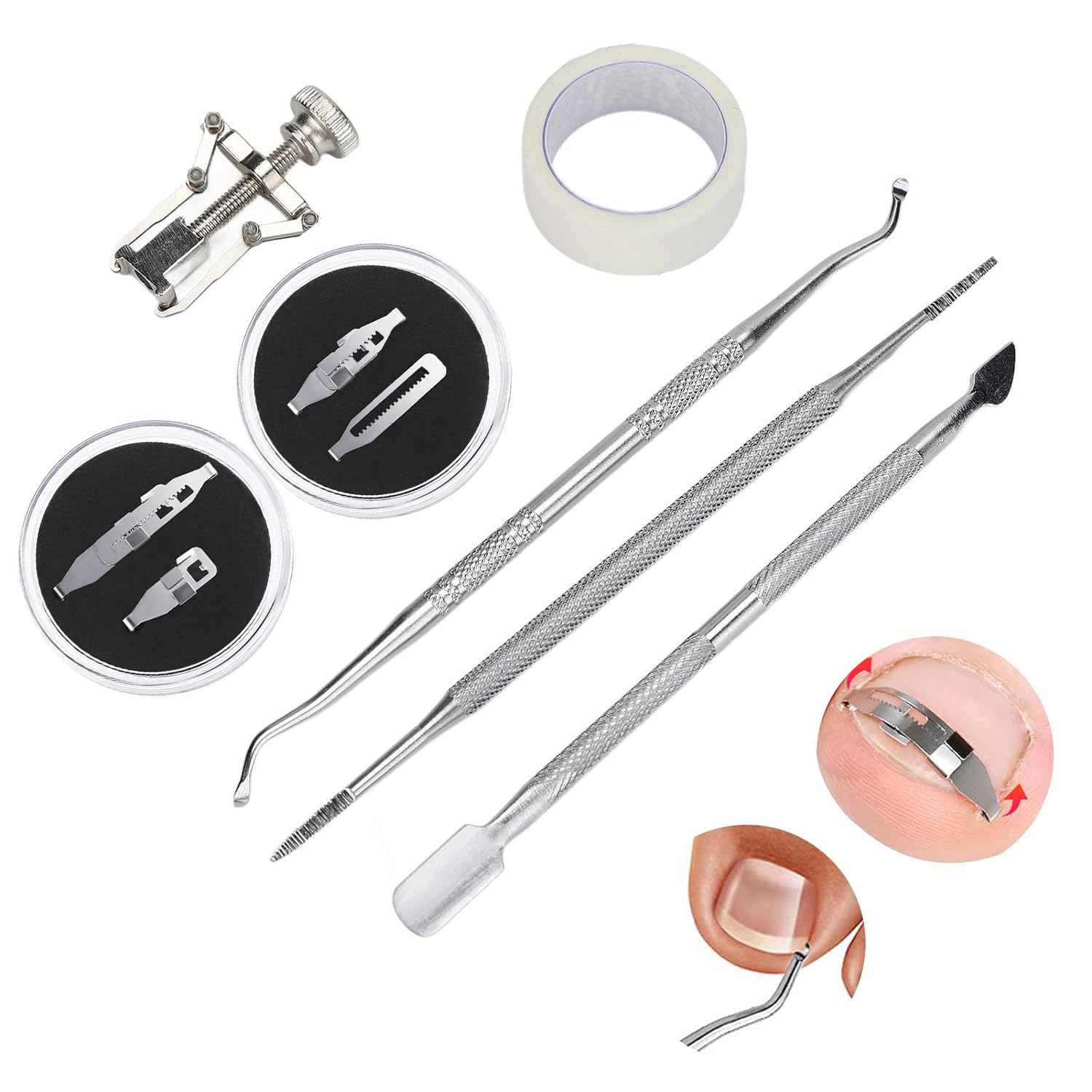 [Upgrade]Toenail Corrector for Ingrowns, Pedicure Tool Straightening Correction Clip, Normal Shoes Are Not Easy to Deform and Durable Tool Set Stainless Steel Portable Paronychia Corrector (2 Sizes)