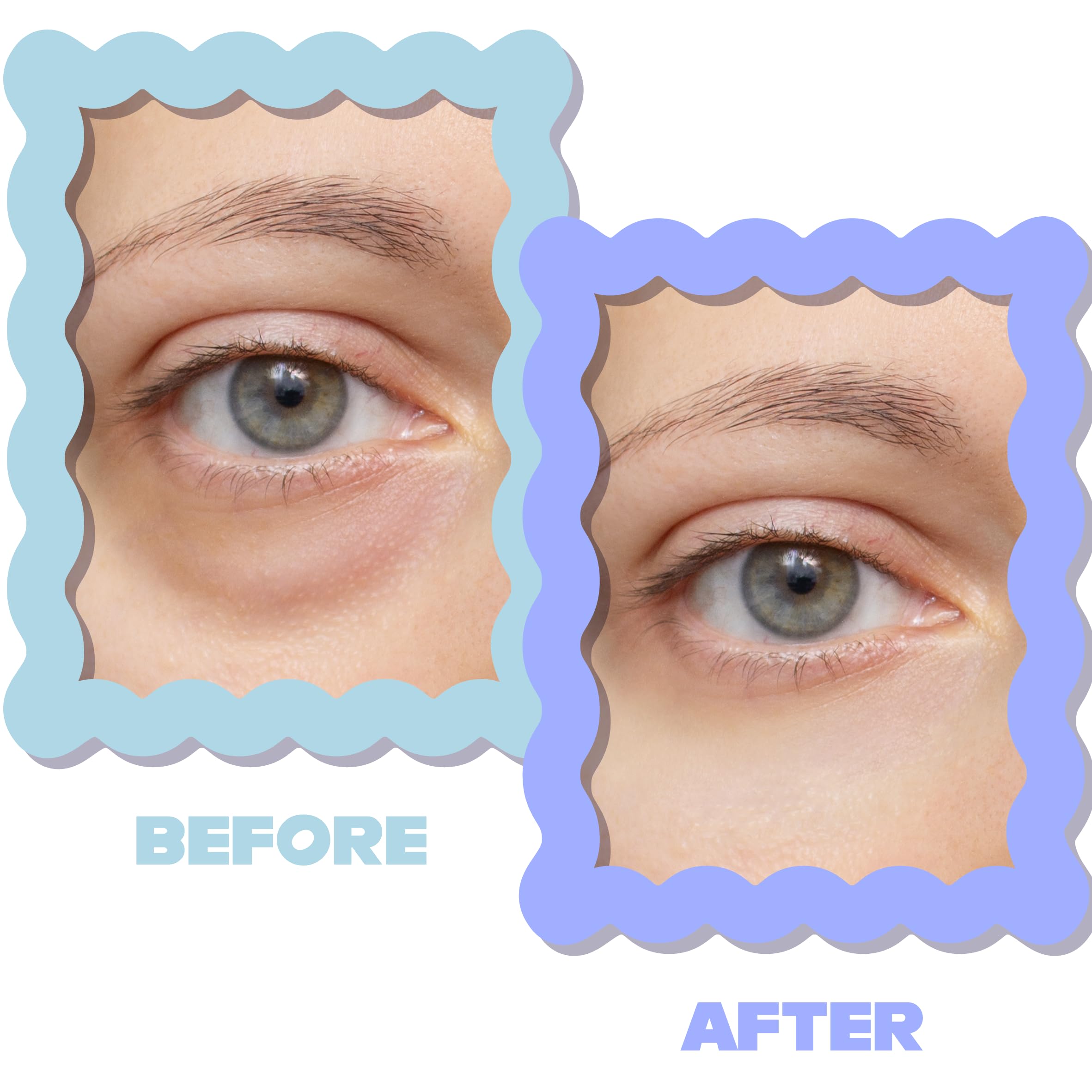 SIRIUSLY BRIGHT Under Eye Patches 28 works - Image 4