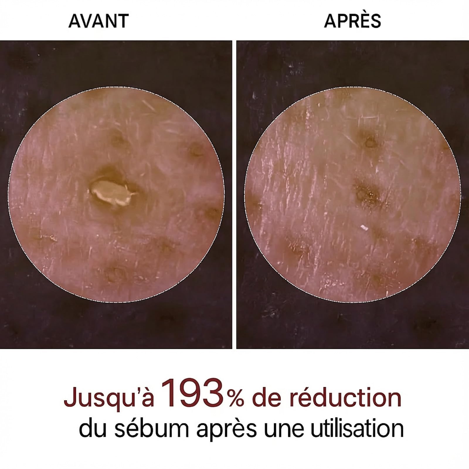 Lumeva Peel Shot Exfoliant Visage Coréen - Sérum Exfoliant Riz Noir & Blanc, Nettoyage Profond des Pores et Points Noirs, Texture Douce, Éclat Immédiat - 80 ml, 2 flacons