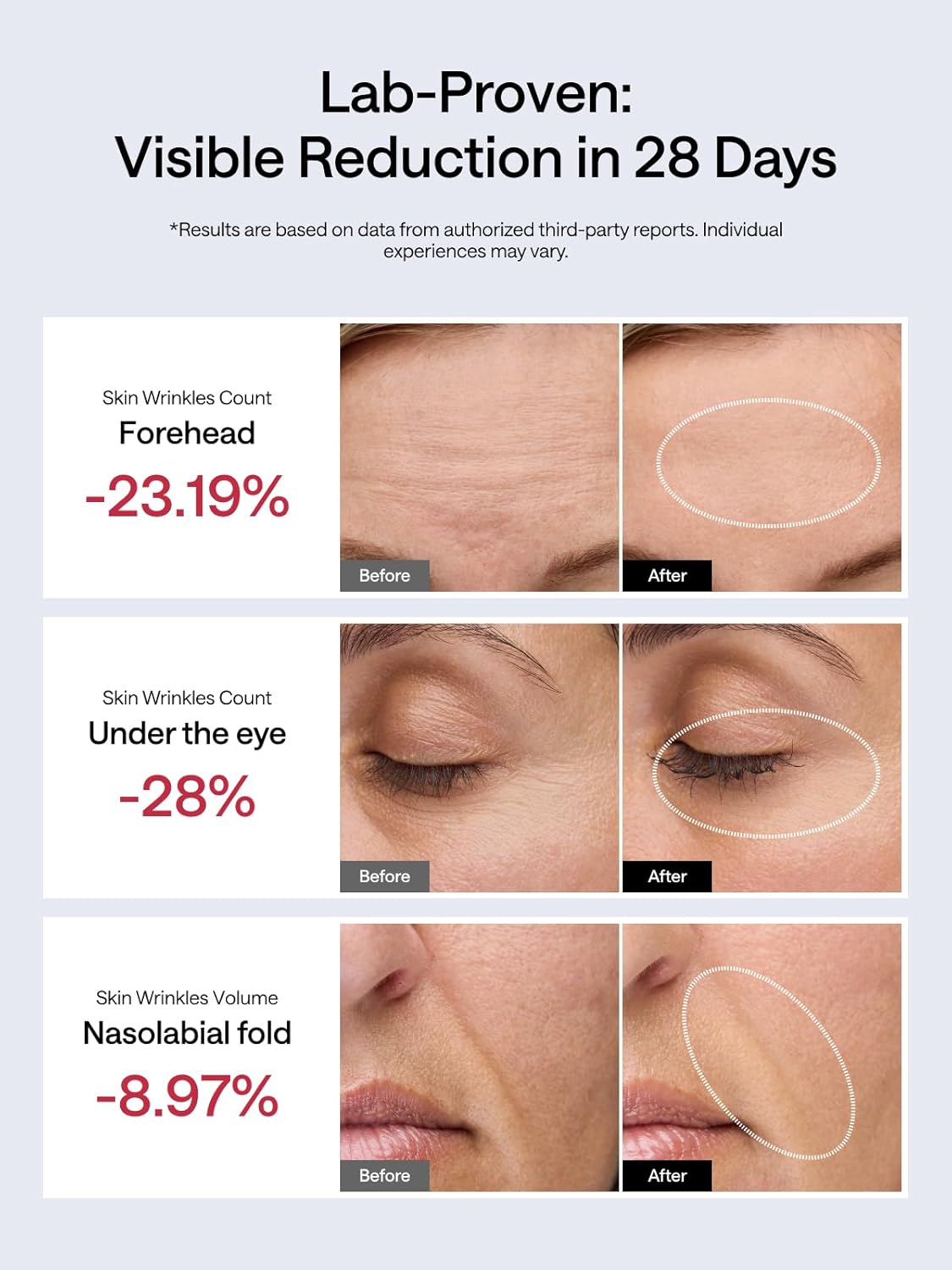 JMOON Microcurrent Facial Device, M30U Red Light Therapy for Face, Safe Anti Aging Skin Care, 4 Modes, 5 Energy Levels for Full Face Lift and Ideal for Smile Lines, Eyes, and Forehead (Pink) - Image 3