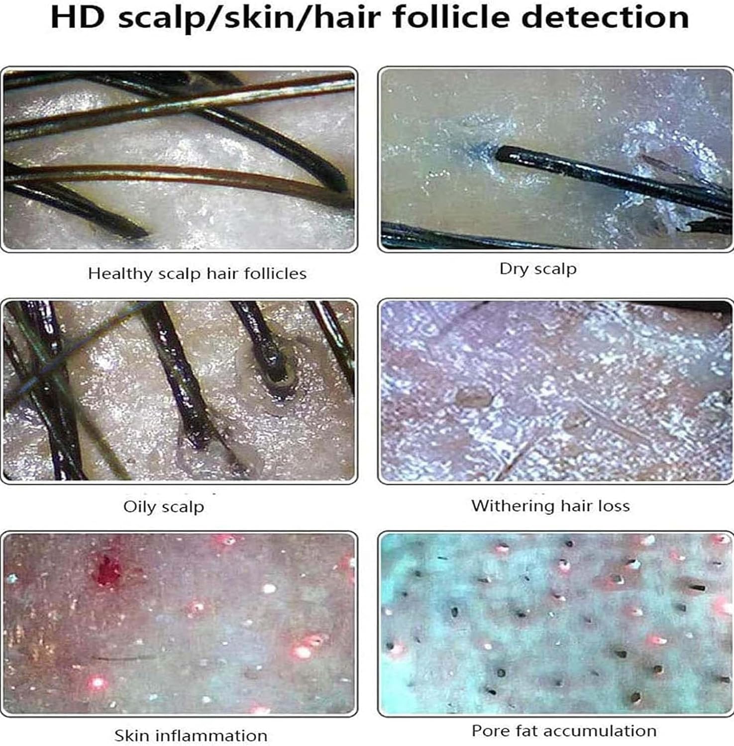 Haar-Haut-Analysegerät, Hautdiagnose-Haaranalysegerät, Con cabezales duales de 50x/200x y un tamaño de folículo de 11 pulgadas, Ideal para salones de belleza