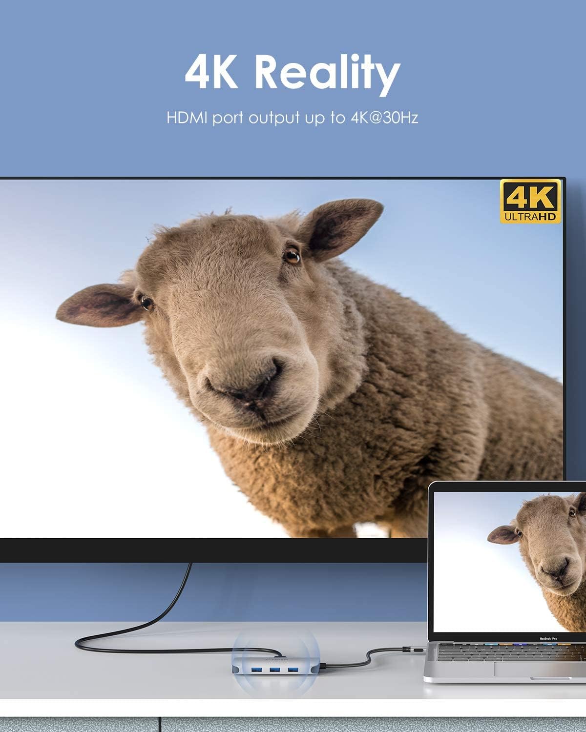 Get Special Price LENTION USB C Hub with 4K HDMI, Gigabit Ethernet, Card Reader, USB 3.0, Type C Data and Charging Adapter Compatible 2021-2016 MacBook Pro, New Mac Air/Surface, Chromebook, More (CB-CE57, Space Gray)