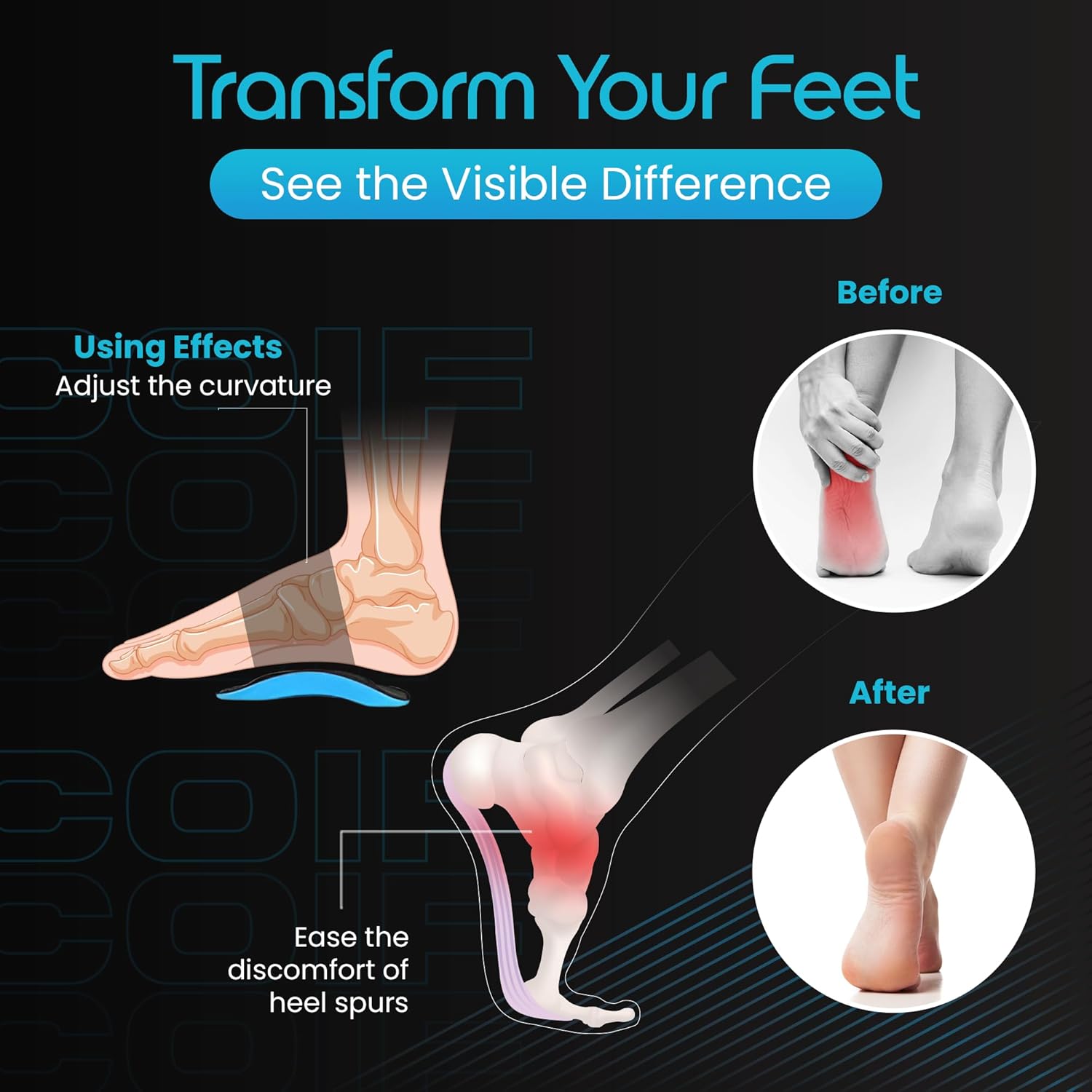 COIF Foot Care Plantar Arch Support for Men & Women for Pain Relief of Plantar Fasciitis, Flat & Fallen Arches, High Arch, Heel Spurs, Flat Feet COIF Foot Care Plantar Arch Support for Men & Women for Pain Relief of Plantar Fasciitis, Flat & Fallen Arches, High Arch, Heel Spurs, Flat Feet