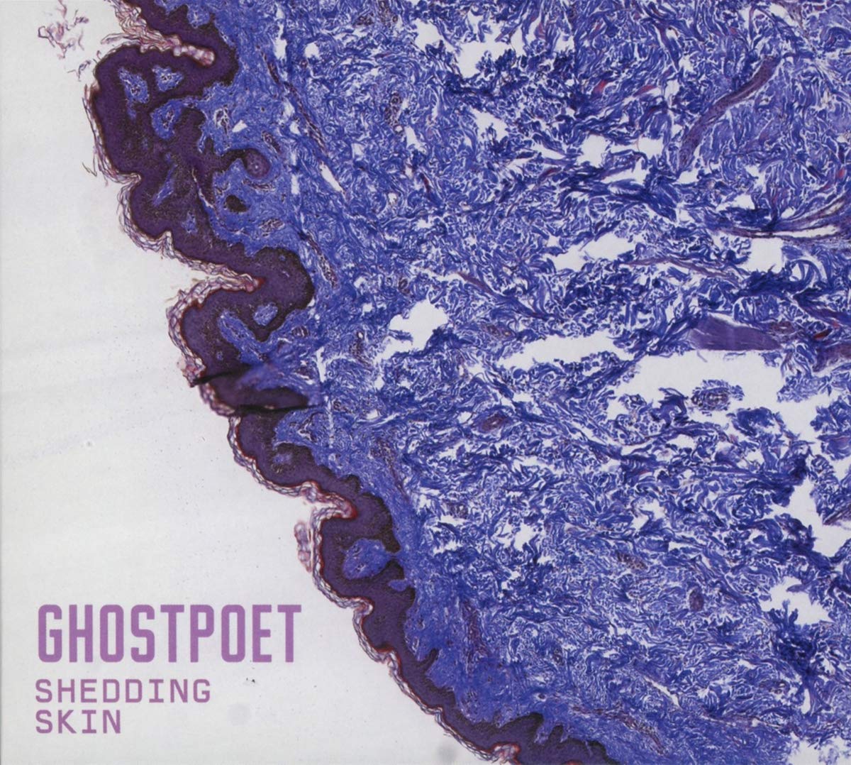 Shedding Skin, , New