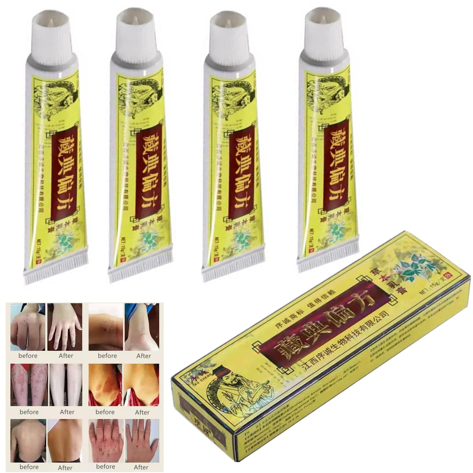 Buy 4pcs Natural Chinese al Eczema Psoriasis Cream Dermatitis Pruritus