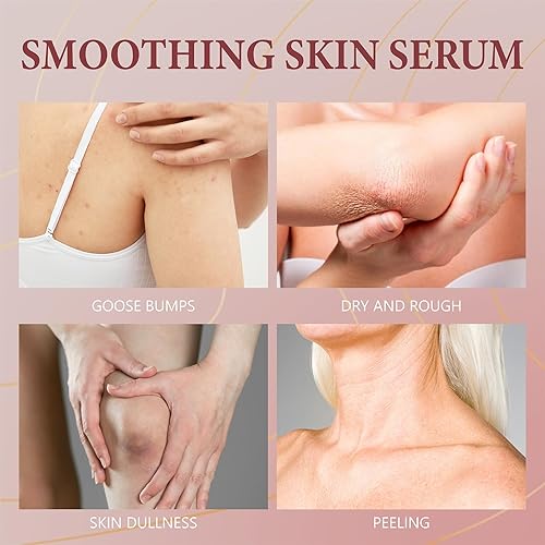 Miniatura 7 de B Glossy - Suero corporal para arrugas, suero corporal suavizante brillante B, suero para tensar la piel brillante B para levantar y tensar la piel