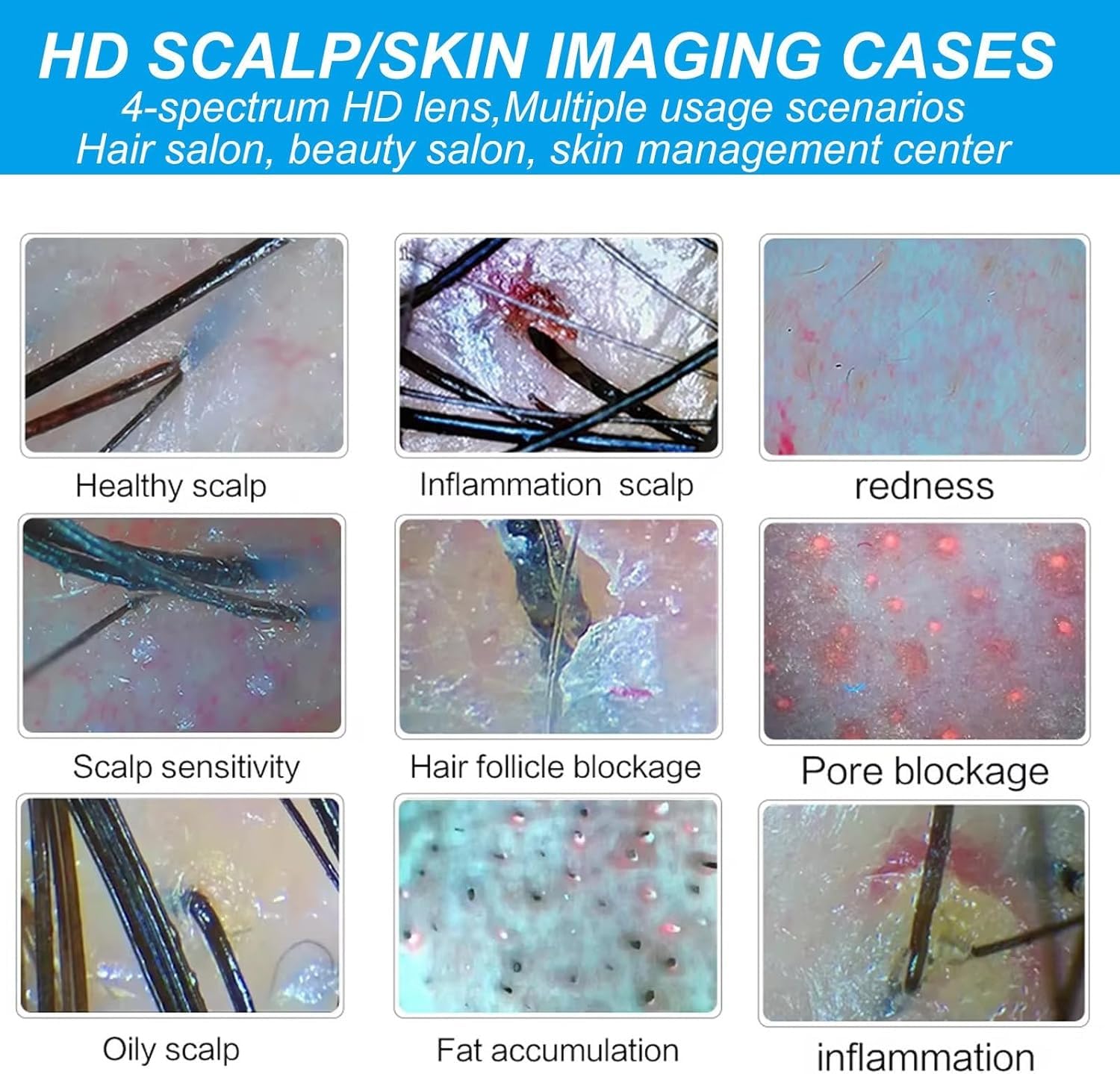 Haut-, Haar- und Kopfhautdetektor, Hautdiagnose-Haaranalysator, 15 Zoll 50X 200X Linse Kopfhaut-Haarfollikel-Hauthaardetektor-Analysegerät
