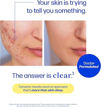 Clear Skin Supplement Acne Support, Zinc DIM, Probiotics, Doctor-Formulated | 3-in-1 Hormone, Gut & Complexion Support, Triple Action Hyaluronic Acid & Vitamins for Skin Balance and Glow, 60 Capsules
