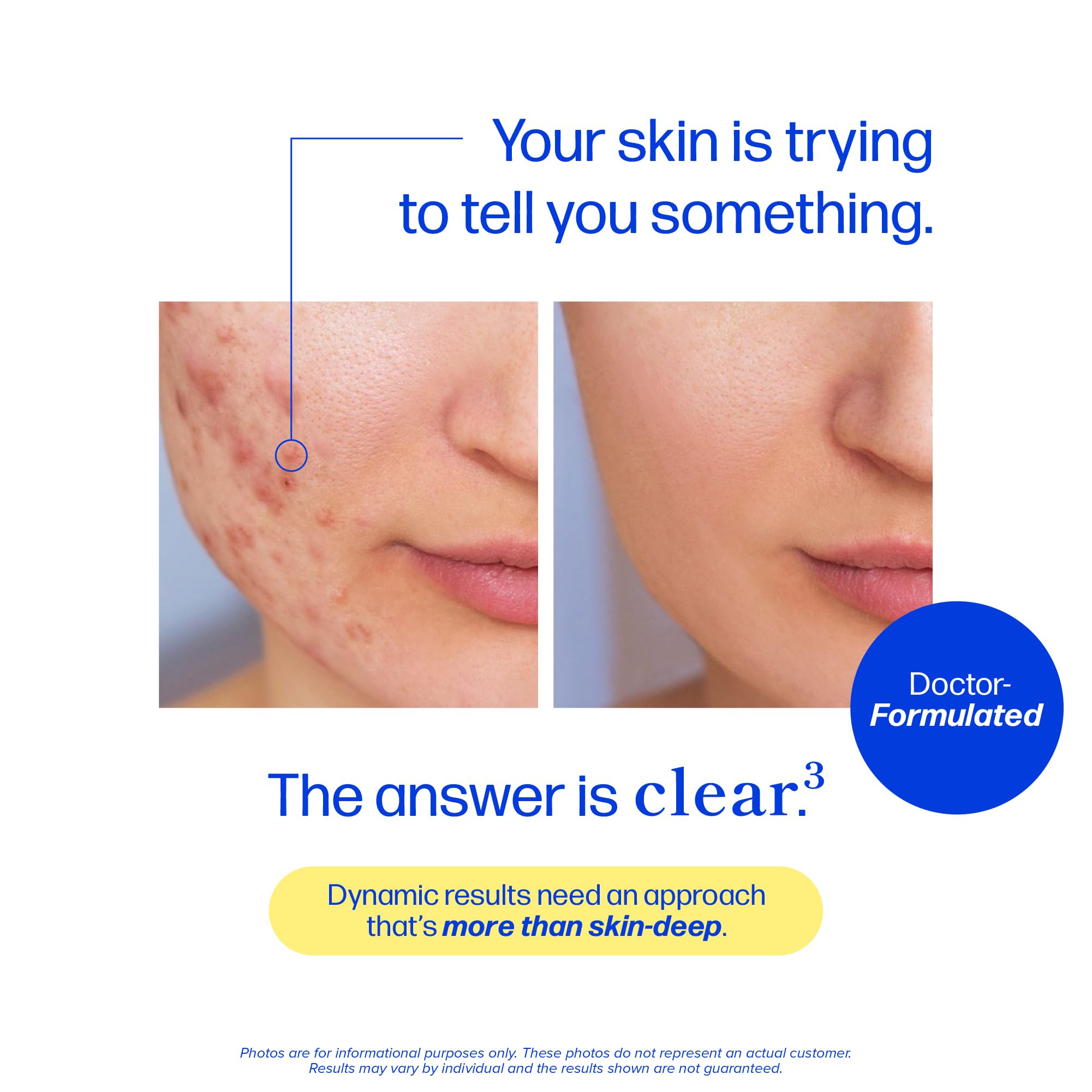 Clear Skin Supplement Acne Support, Zinc DIM, Probiotics, Doctor-Formulated — Amazon image 3