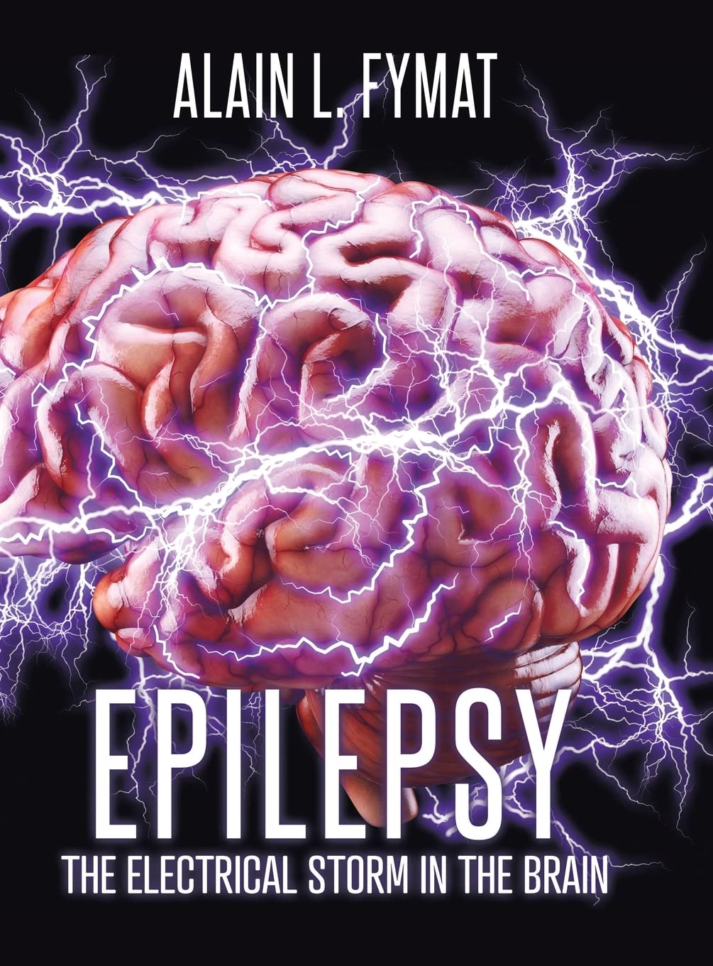 Epilepsy: The Electrical Storm in the Brain      Hardcover – September 29, 2022
