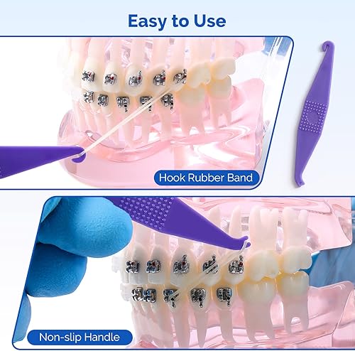 Miniatura 5 de JMU Bandas elásticas de ortodoncia 14 medianas de 4.5 onzas, 0.252 in, 500 bandas de goma ortodónticas de látex, bandas de goma dentales