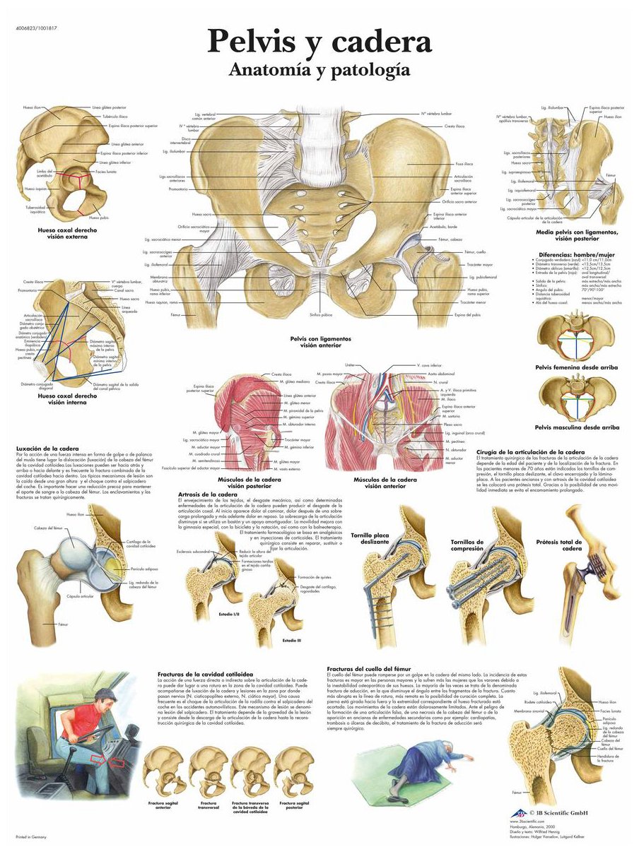 3B Scientific VR3172UU Printed On Paper, Pelvis & Hips, Anatomy & Pathology