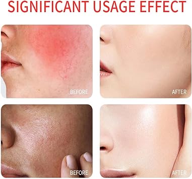 UV Clear Mineral Sunscreen SPF 50+ for Face & Sensitive Skin, Zinc Oxide Sun Cream, Broad-Spectrum UV Protection, No White Cast, Lightweight Non-Greasy, 50ml