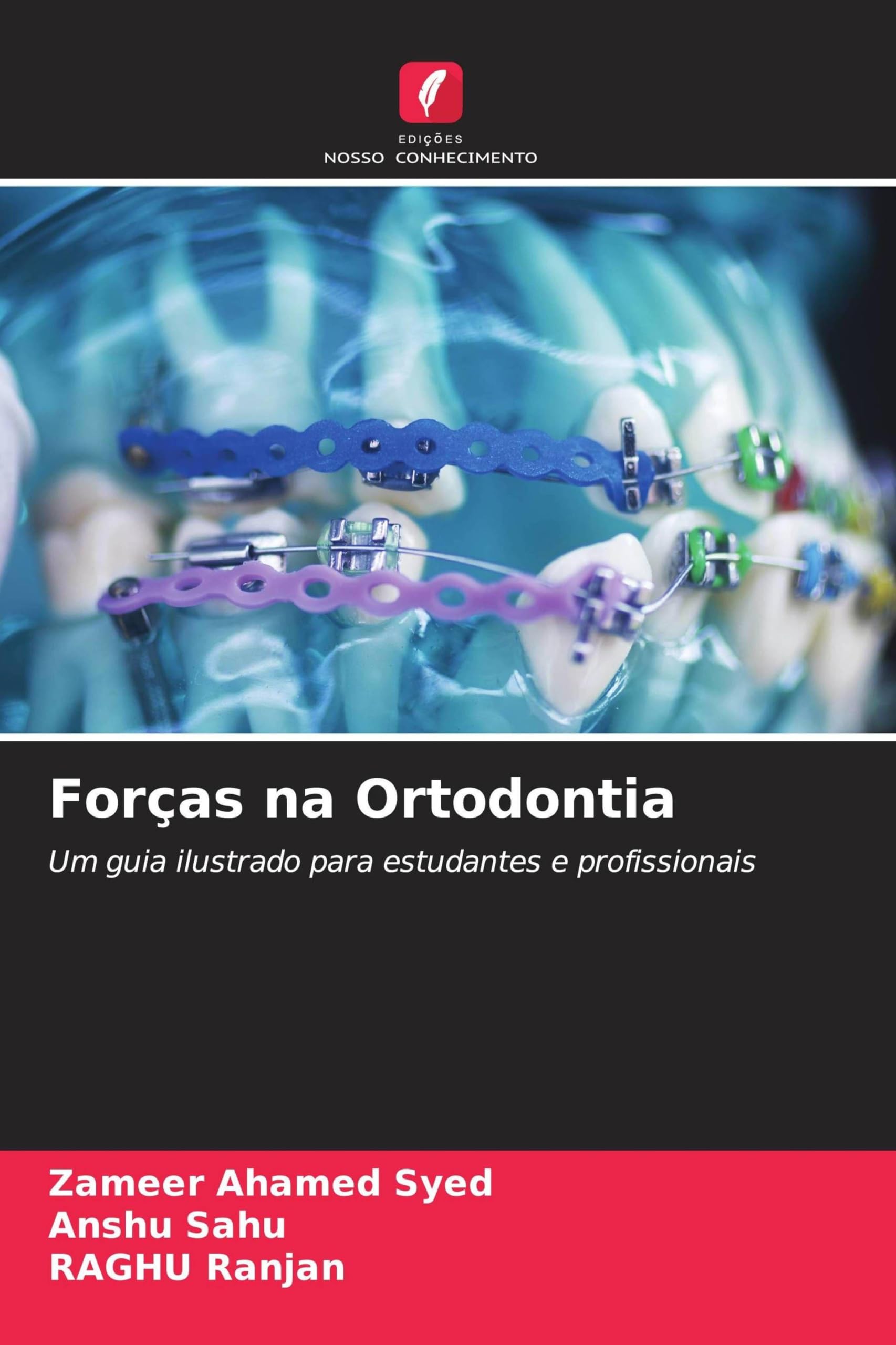 Forças na Ortodontia: Um guia ilustrado para estudantes e profissionais