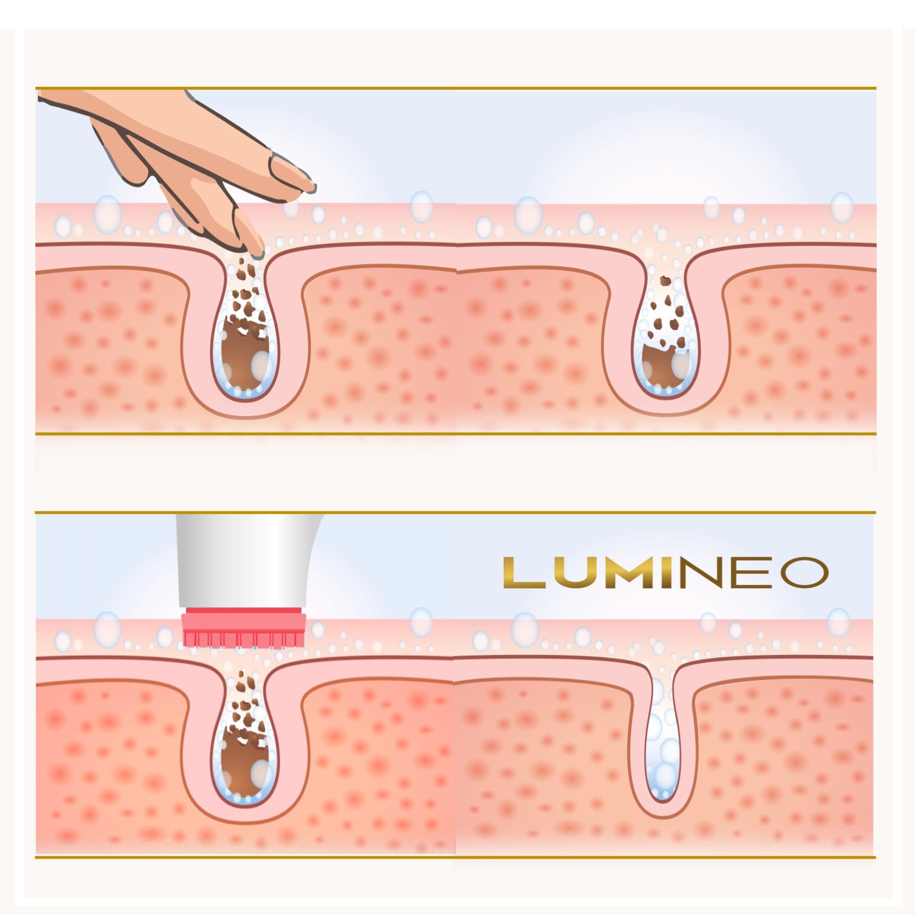 Lumineo PRO pulizia profonda del viso, spazzola per il viso con 4 accessori, USB-C, impermeabile IPX6, con gel detergente abbinato per pelli sensibili (rosa)