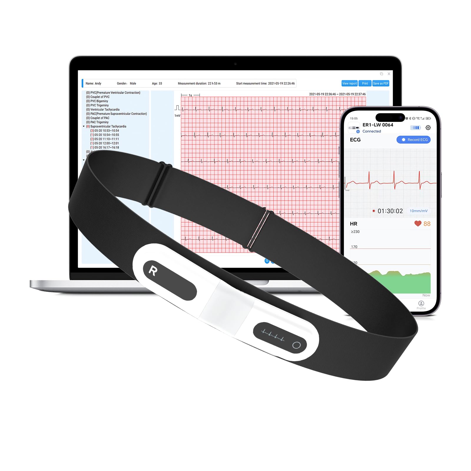 CheckMe ER1-LW Monitor ECG Portatile per 72 Ore con Analisi ECG AI,Holter ECG monitor con Schermo OLED,Funzione Marcatore Evento ECG,App e PC-software,Compatibile con Elettrodi a scatto da 4 mm