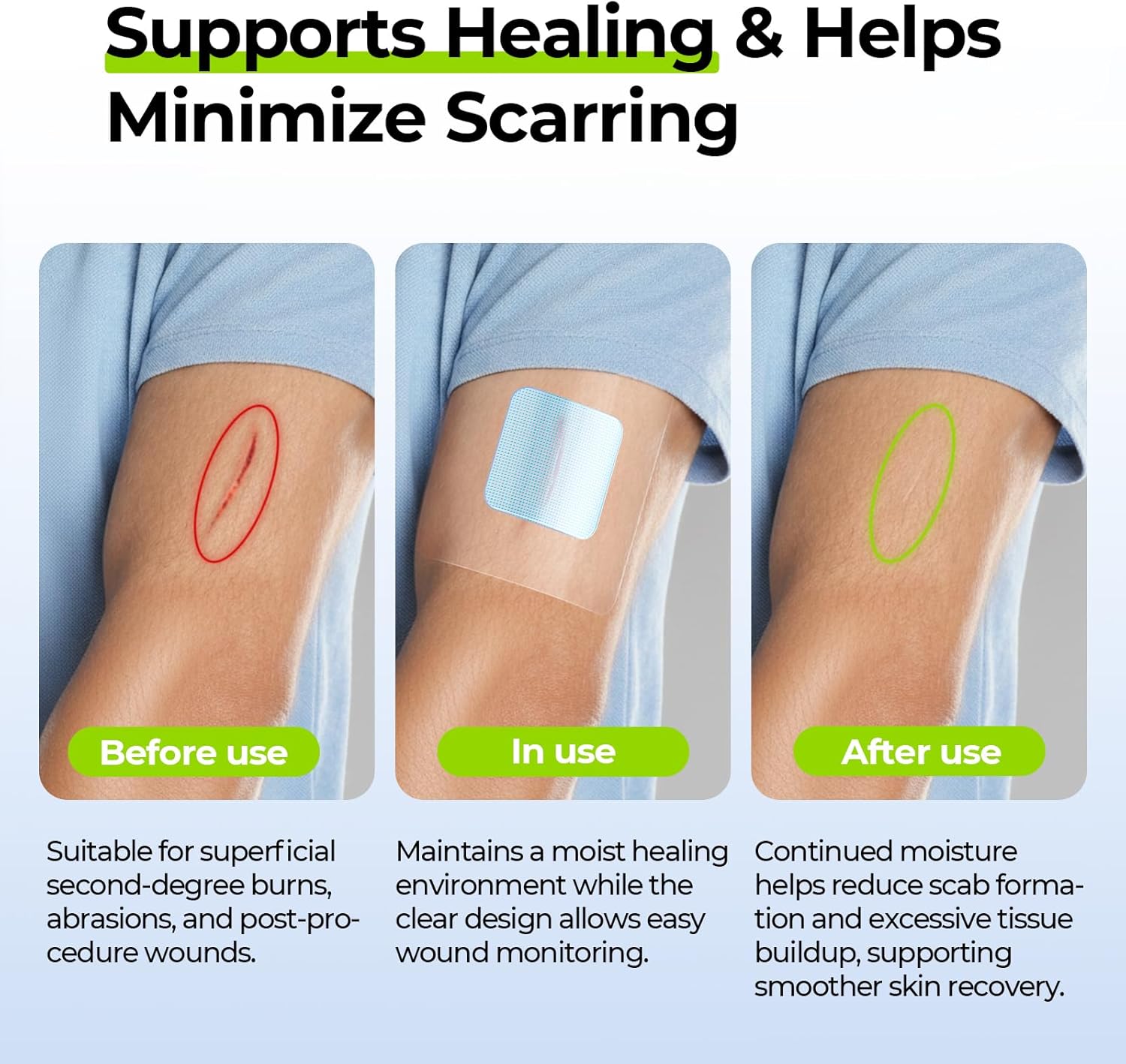 AUVON Hydrogel Burn Dressings 4" x 4" for Instant Cooling Relief & Moist Healing, Adhesive Burn Pads for 1st-2nd Degree Burns, Cuts, Abrasions, Waterproof Wound Dressing for Home First Aid Kit, 10 Pcs - Image 5