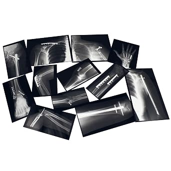 Roylco R-59255 Fixed Bones X-Rays, Black/White, 14 Pieces, ModelR59255