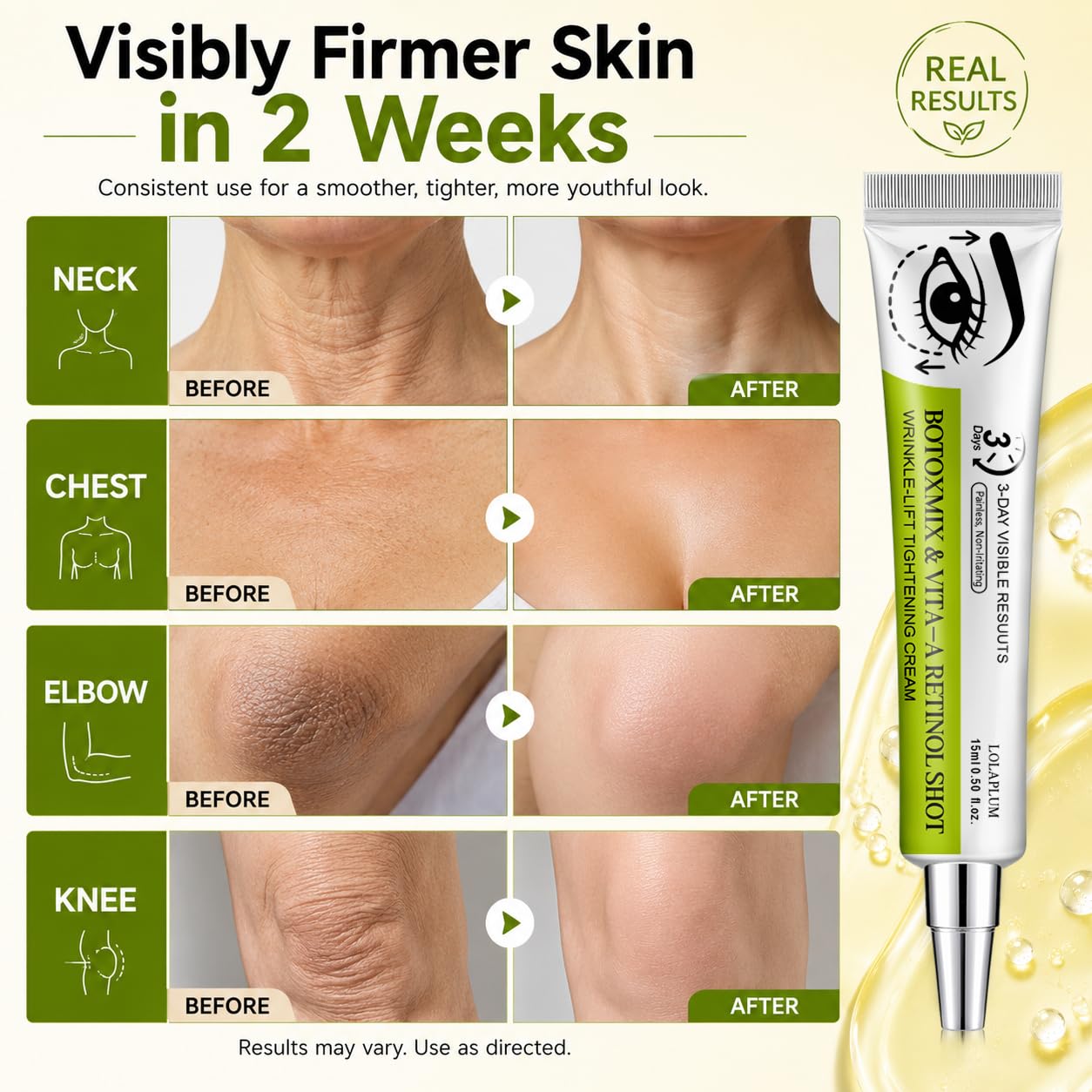 Botoxmix & Vita-A Retinol Shot Wrinkle-Lift Tightening Cream, Effectively lifts and firms the skin, and reduces wrinkles and fine lines, Improves Skin Texture, Non-Irritating, All Skin Types, 2Pack K2