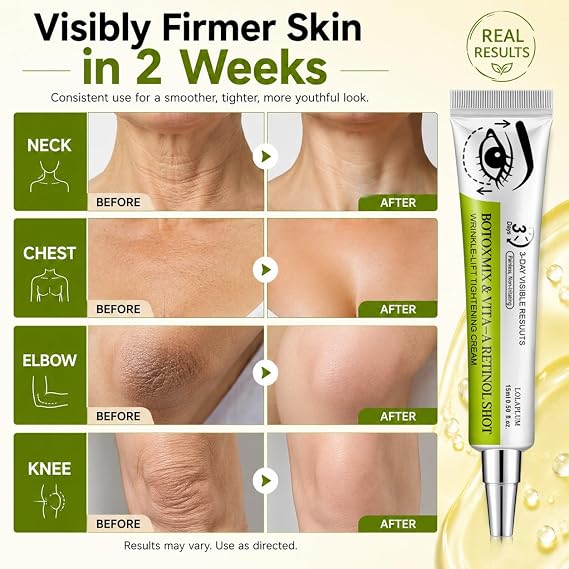 Botoxmix & Vita-A Retinol Shot Wrinkle-Lift Tightening Cream, Effectively lifts and firms the skin, and reduces wrinkles and fine lines, Improves Skin Texture, Non-Irritating, All Skin Types, 2Pack QQ