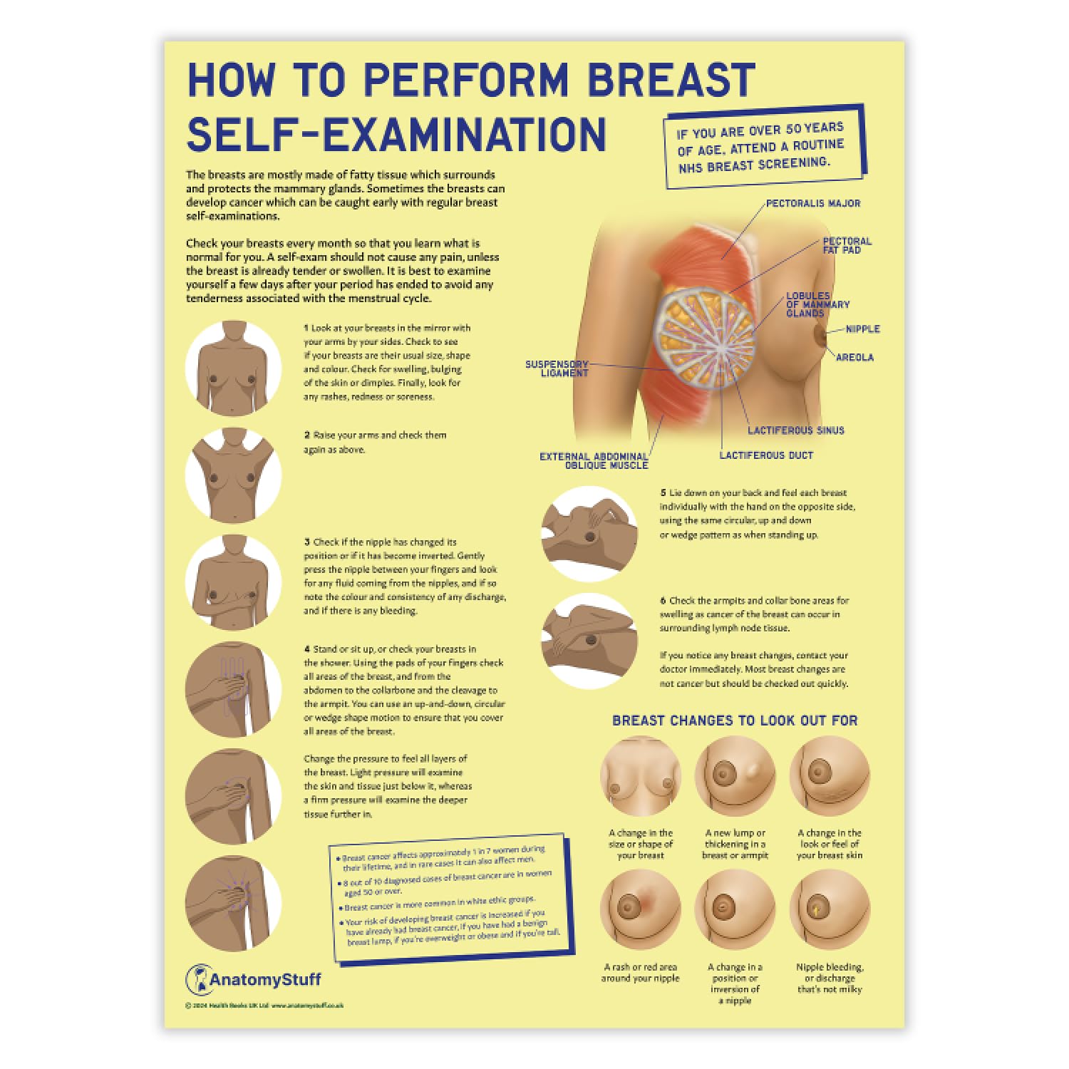 Anatomy Stuff Bse Anatomystuff How To Perform Breast Self-Examination (Bse) Poster/Chart, 45X60 Cm, 18X24 Inches, Breast Anatomy, Breast Cancer Awareness